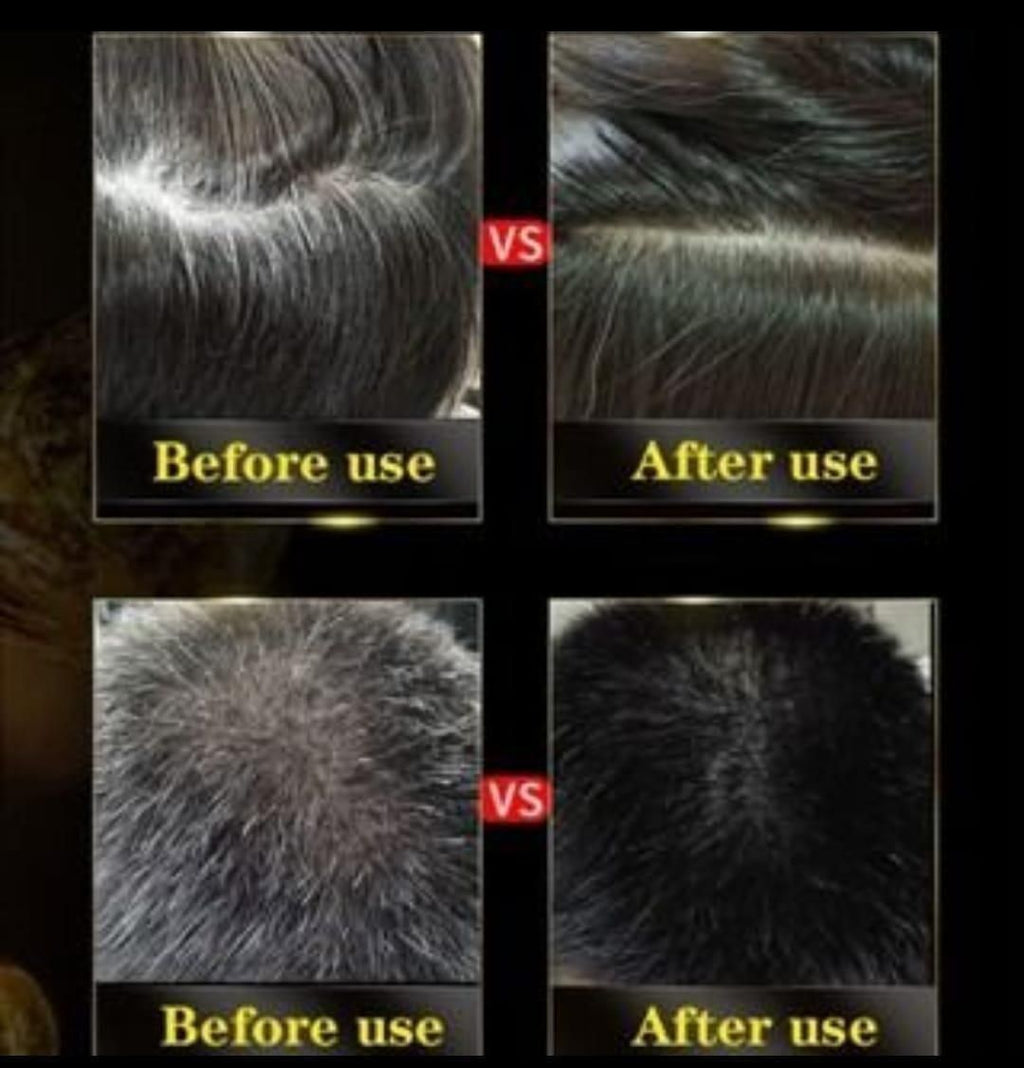 Instant Black Herbal Hair Dye Shampoo, Natural Coverage in 5 Mins (3 in one 100ml) Pack Of 2